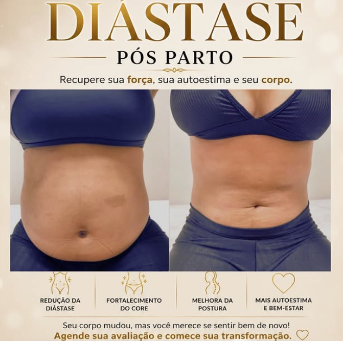 Registro de acompanhamento abdominal no pós-parto